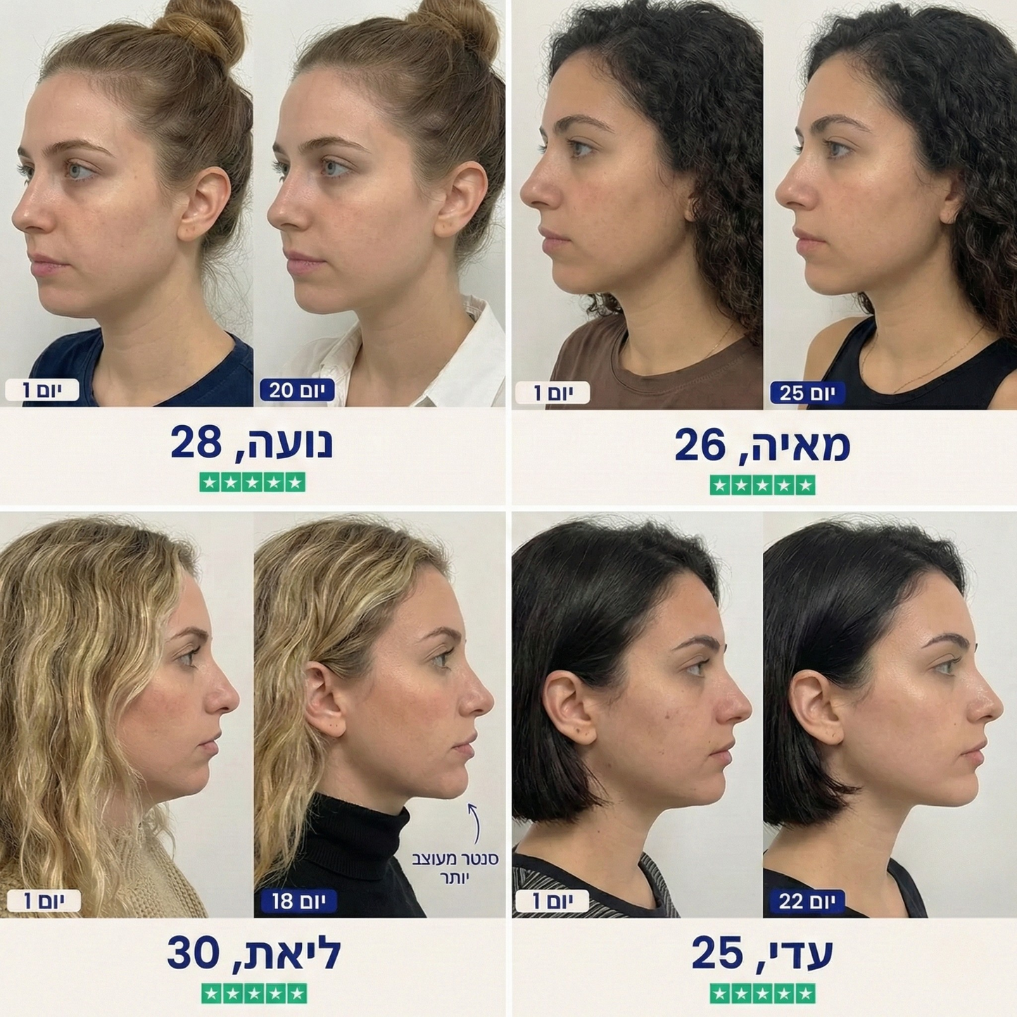 מעצב קו הלסת- Jawly